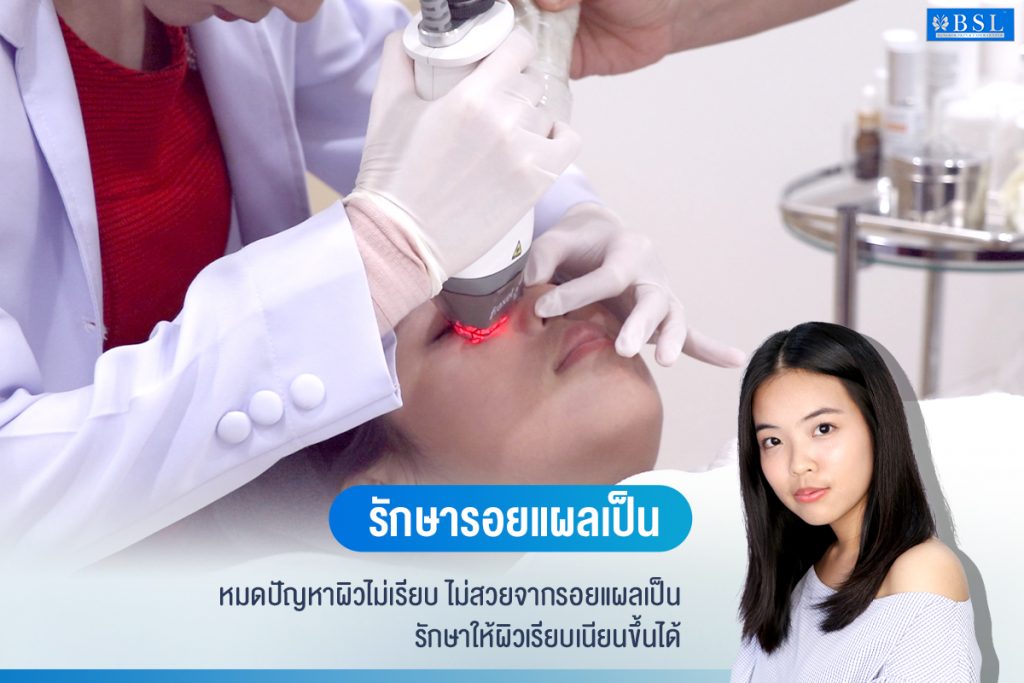 รักษารอยแผลเป็นให้จางลง