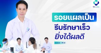 รอยแผลเป็น รีบรักษาเร็ว ยิ่งได้ผลดี